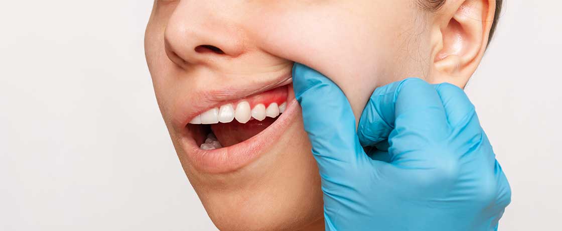 Periodontoloji