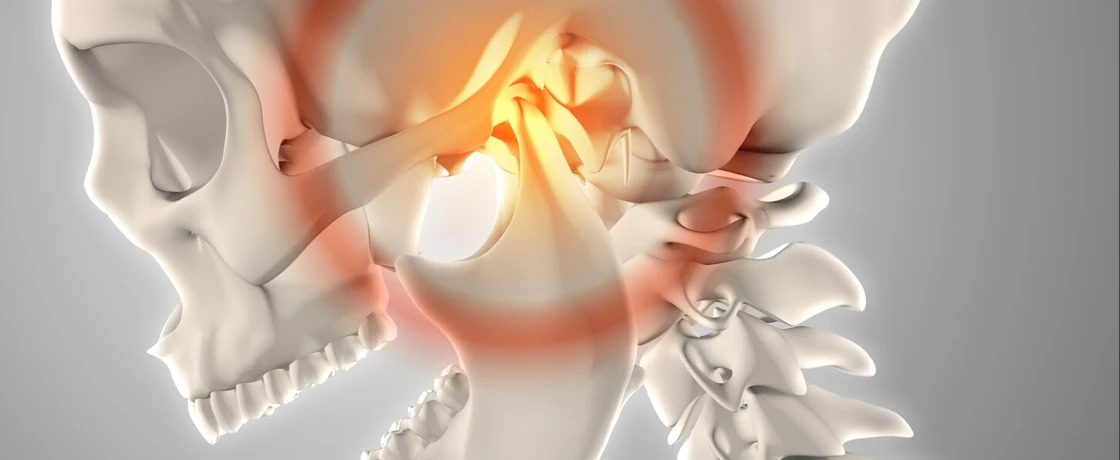 Temporomandibular eklem (TME) bozuklukları ve tedavileri
