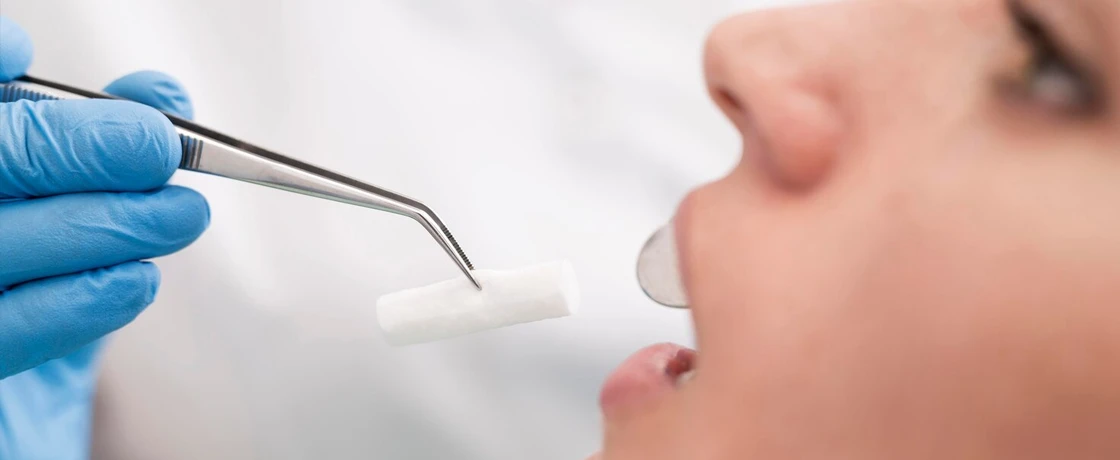 Diş Çürüklerinin İlk Belirtileri Nelerdir?